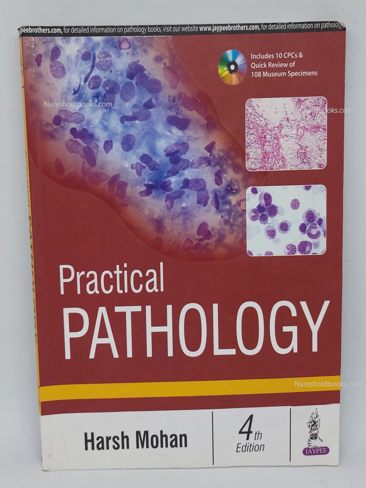 Practical Pathology harsh mohan 4th ed