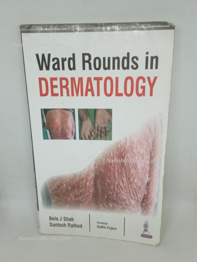 Ward Rounds in Dermatology Bela J Shah Santosh Rathod